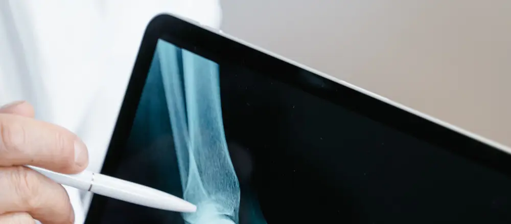 An X-ray displayed on a screen during a discussion.